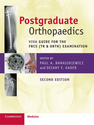 Postgraduate Orthopaedics: Viva Guide for the FRCS (Tr & Orth) Examination, 2nd Edition