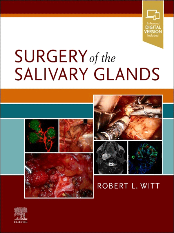 Surgery of the Salivary Glands by Witt
