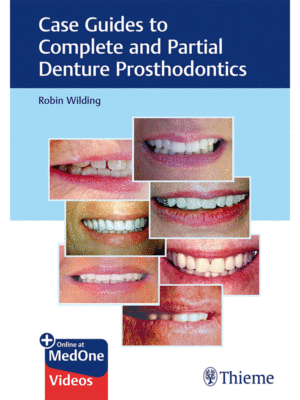Case Guides to Complete and Partial Denture Prosthodontics
