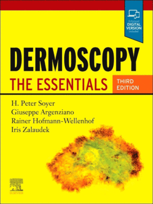 Dermoscopy by Soyer: The Essentials, 3rd Edition