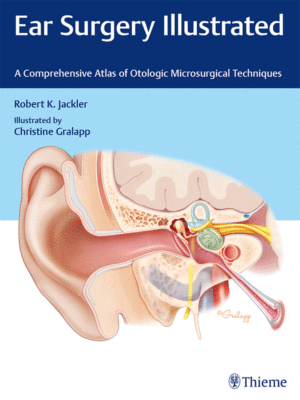 Ear Surgery Illustrated by Jackler: A Comprehensive Atlas of Otologic Microsurgical Techniques