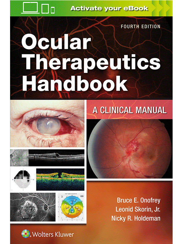 Ocular Therapeutics Handbook by Onofrey: A Clinical Manual, 4th Edition