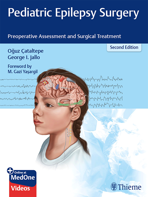 Pediatric Epilepsy Surgery: Preoperative Assessment and Surgical Treatment, 2nd Edition