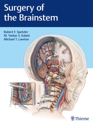 Surgery of the Brainstem by Spetzler