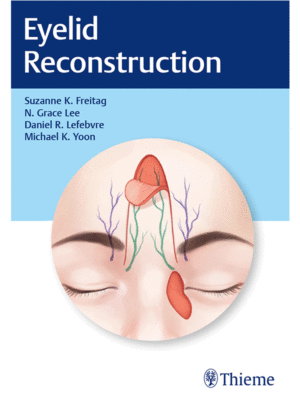 Eyelid Reconstruction