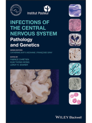 Infections of the Central Nervous System: Pathology and Genetics
