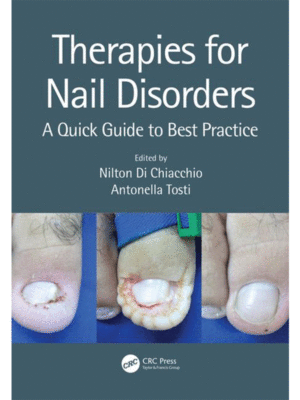 Therapies for Nail Disorders: A Quick Guide to Best Practice
