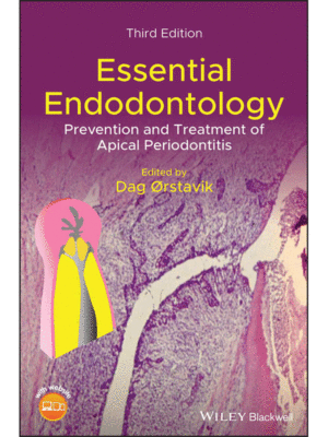 Essential Endodontology: Prevention and Treatment of Apical Periodontitis, 3rd Edition