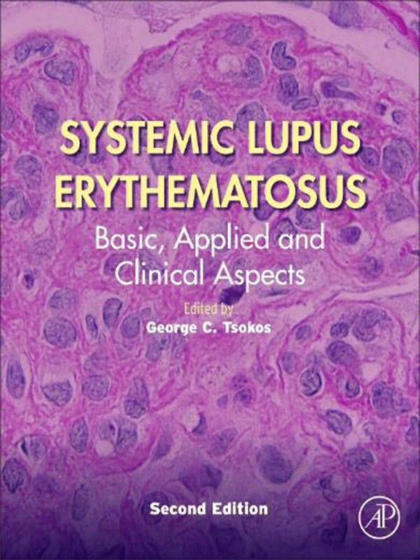 Systemic Lupus Erythematosus by Tsokos