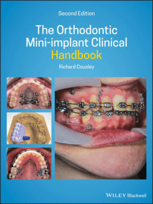 The Orthodontic Mini-implant Clinical Handbook, 2nd Edition