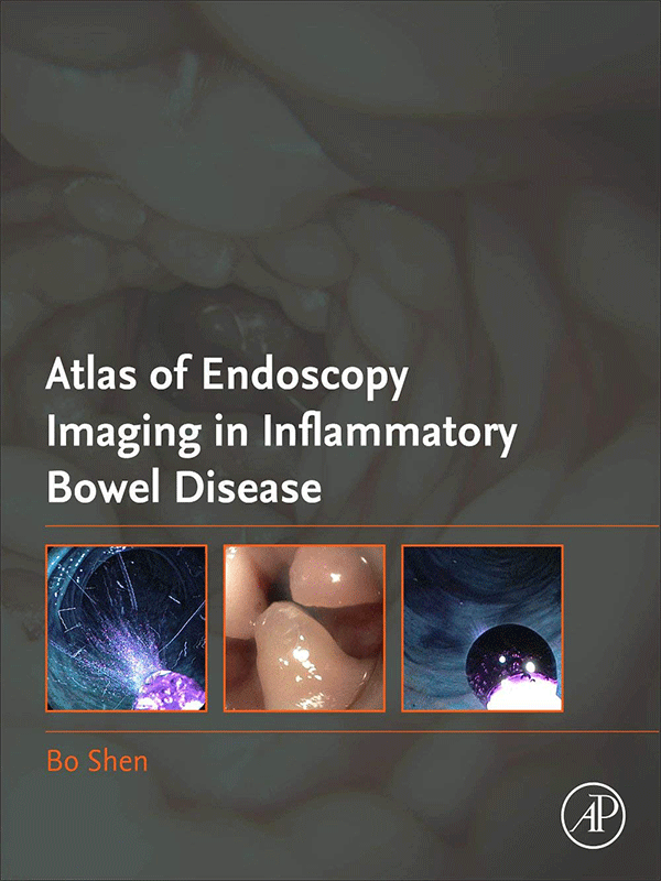 Atlas of Endoscopy Imaging in Inflammatory Bowel Disease