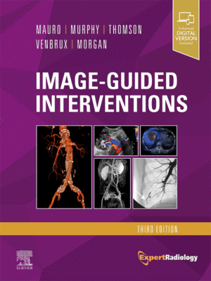 Image-Guided Interventions, 3rd Edition (Expert Radiology Series)