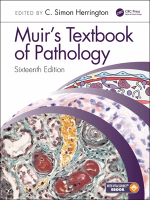 Muir's Textbook of Pathology, 16th Edition