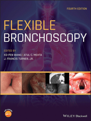Flexible Bronchoscopy by Wang, 4th Edition