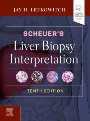 Scheuer's Liver Biopsy Interpretation, 10th Edition