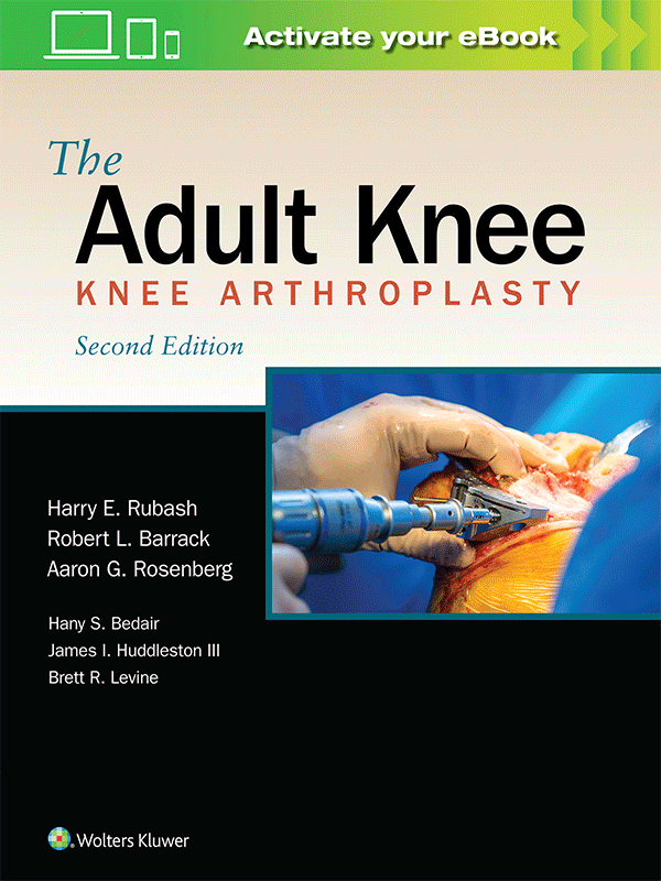 The Adult Knee: Knee Arthroplasty, 2nd Edition