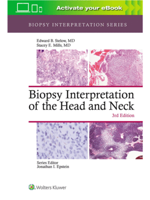 Biopsy Interpretation of the Head and Neck, 3rd Edition