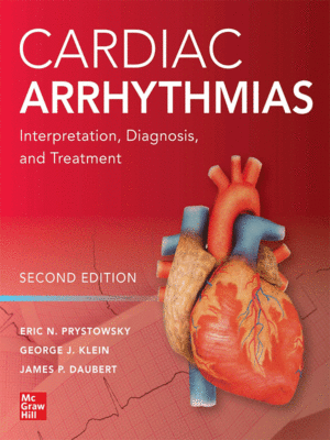 Cardiac Arrhythmias: Interpretation, Diagnosis and Treatment, 2nd Edition