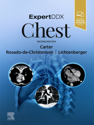 ExpertDDx: Chest, 2nd Edition