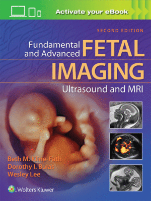 Fundamental and Advanced Fetal Imaging: Ultrasound and MRI, 2nd Edition