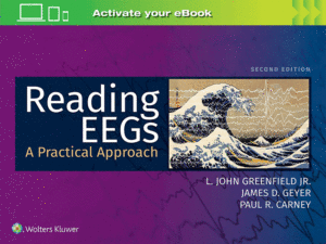 Reading EEGs: A Practical Approach, 2nd Edition