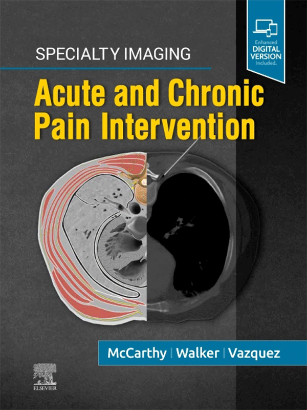Specialty Imaging: Acute and Chronic Pain Intervention Specialty Imaging: Acute and Chronic Pain Intervention