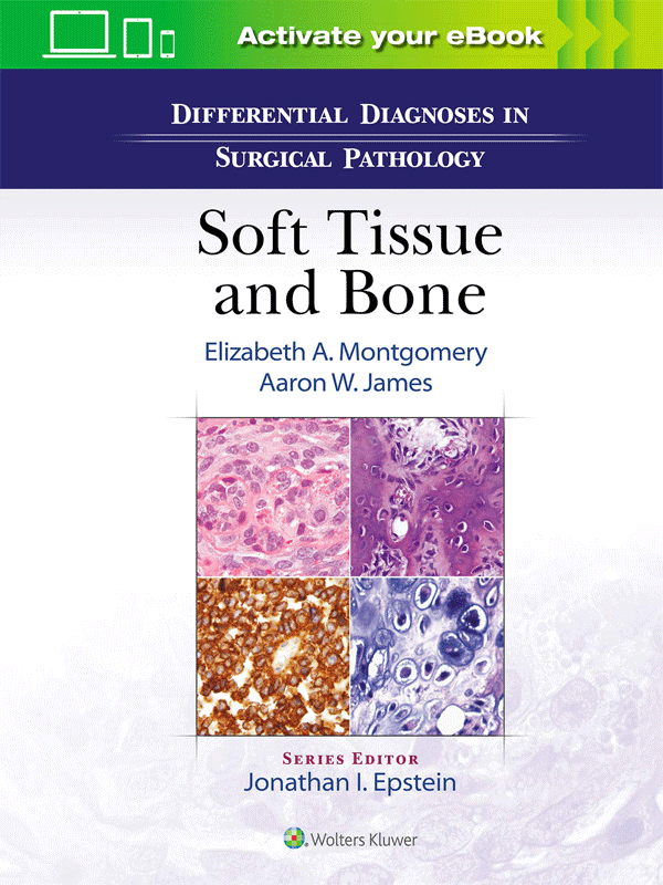 Differential Diagnoses in Surgical Pathology Soft Tissue and Bone Vasiliadis Medical Books