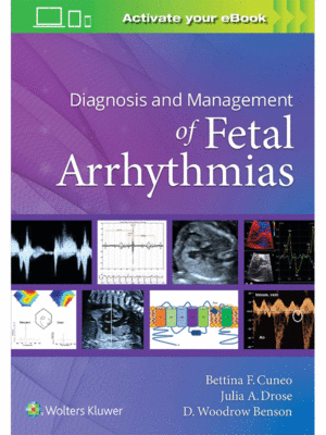 Diagnosis and Management of Fetal Arrhythmias
