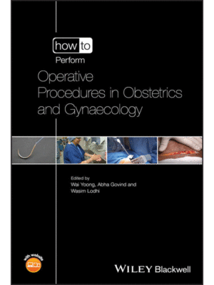 How to Perform Operative Procedures in Obstetrics and Gynaecology