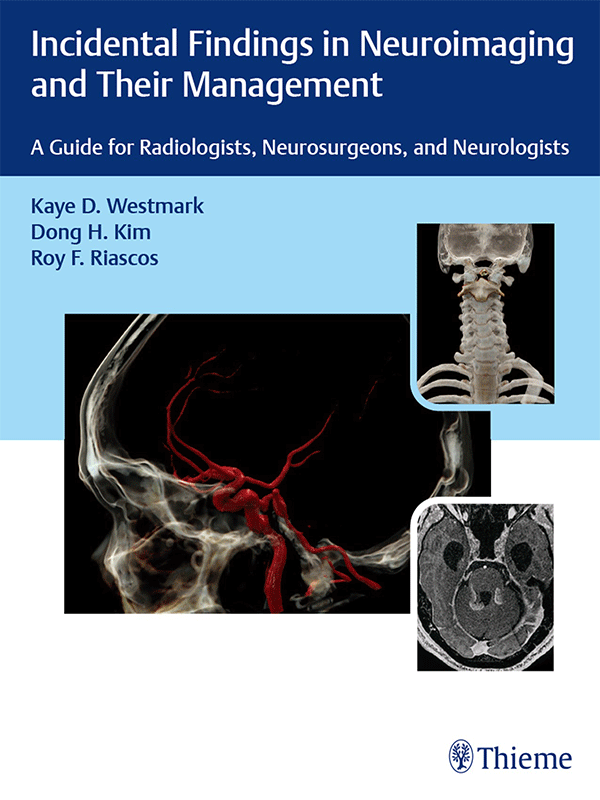 Incidental Findings in Neuroimaging and Their Management: A Guide for Radiologists, Neurosurgeons, and Neurologists