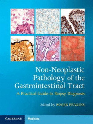 Non-Neoplastic Pathology of the Gastrointestinal Tract: A Practical Guide to Biopsy Diagnosis with Online Resource