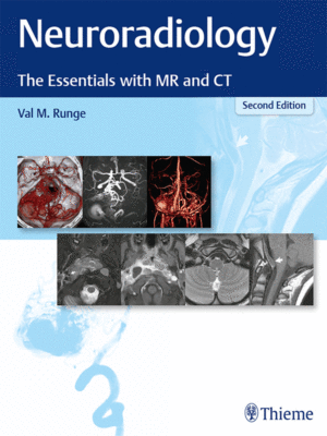 Neuroradiology: The Essentials with MR and CT, 2nd Edition
