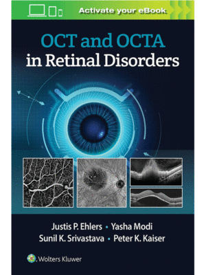 OCT and OCTA in Retinal Disorders