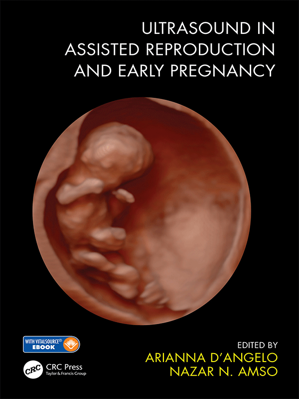 Ultrasound in Assisted Reproduction and Early Pregnancy Ultrasound in Assisted Reproduction and Early Pregnancy