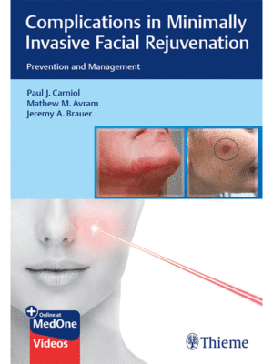 Complications in Minimally Invasive Facial Rejuvenation: Prevention and Management
