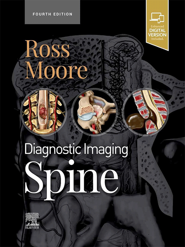 Diagnostic Imaging Spine, 4th Edition Vasiliadis Medical Books