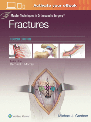 Master Techniques in Orthopaedic Surgery: Fractures, 4th Edition