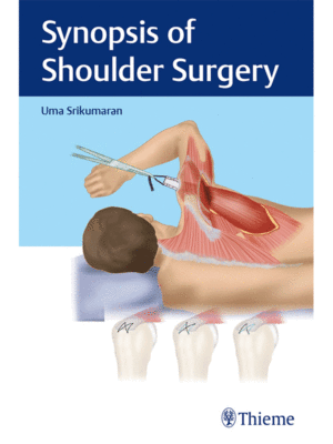 Synopsis of Shoulder Surgery