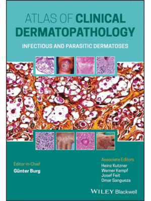 Atlas of Clinical Dermatopathology: Infectious and Parasitic Dermatoses