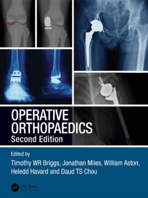 Operative Orthopaedics, 2nd Edition