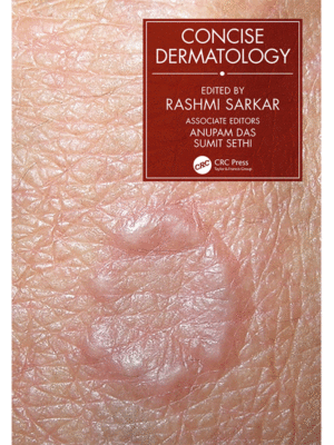 Concise Dermatology by Sarkar