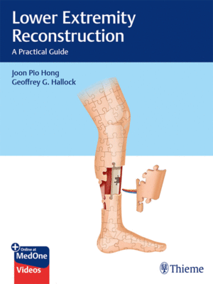 Lower Extremity Reconstruction: A Practical Guide