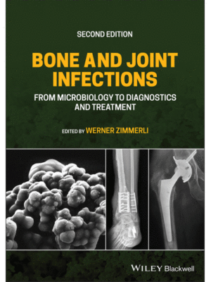 Bone and Joint Infections: From Microbiology to Diagnostics and Treatment, 2nd Edition