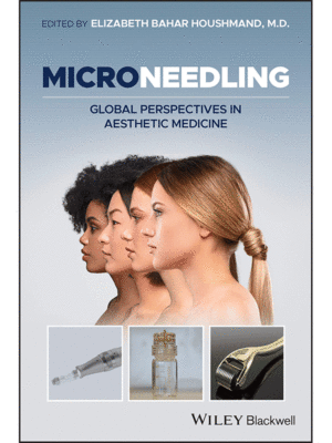 Microneedling: Global Perspectives in Aesthetic Medicine