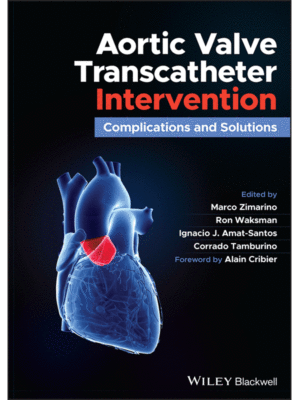 Aortic Valve Transcatheter Intervention: Complications and Solutions
