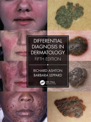 Differential Diagnosis in Dermatology, 5th Edition