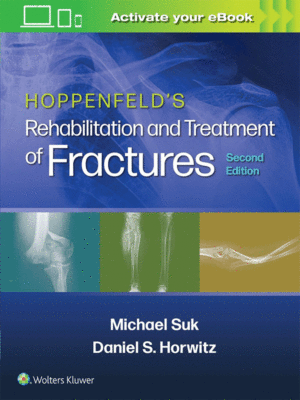 Hoppenfeld's Rehabilitation and Treatment of Fractures, 2nd Edition