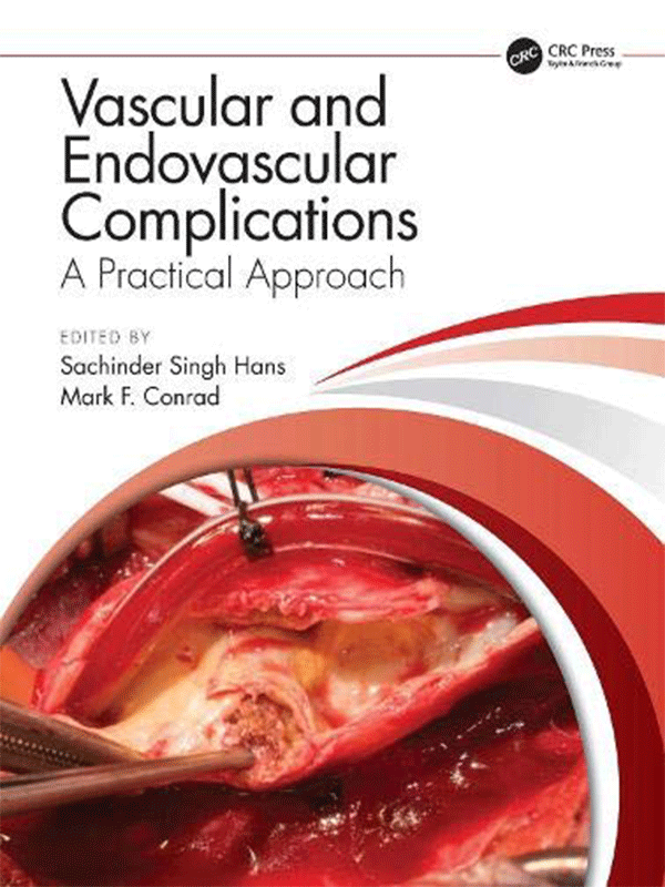 Vascular and Endovascular Complications: A Practical Approach Vascular and Endovascular Complications: A Practical Approach