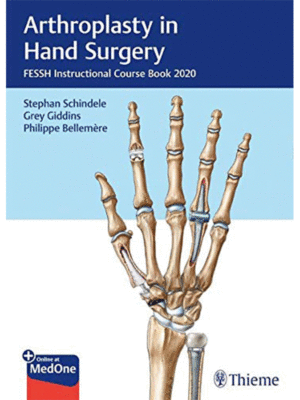 Arthroplasty in Hand Surgery (FESSH Instructional Course Book 2020)