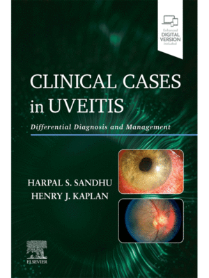 Clinical Cases in Uveitis: Differential Diagnosis and Management